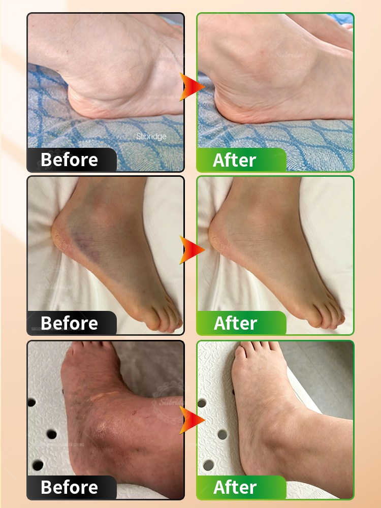 Massageador Portátil Aquecido  - Ankle Brace Support avaliação e preço